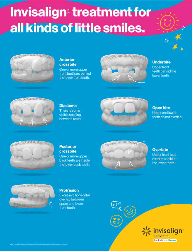Child smiling with Invisalign First aligner